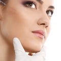 Can Botox Move After 3 Days? - An Expert's Perspective