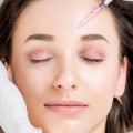 Are botox injections painful for migraines?