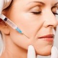 How Often Should You Get Botox Injections?