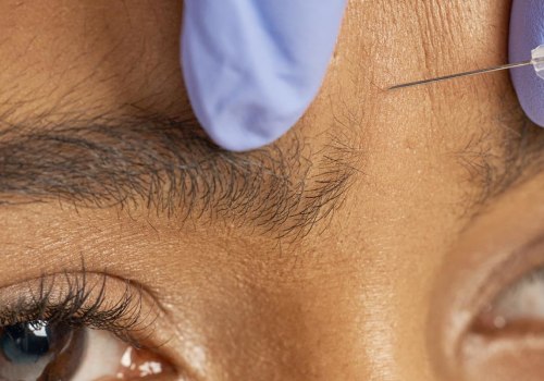 What are the Benefits and Risks of Botox Injections?