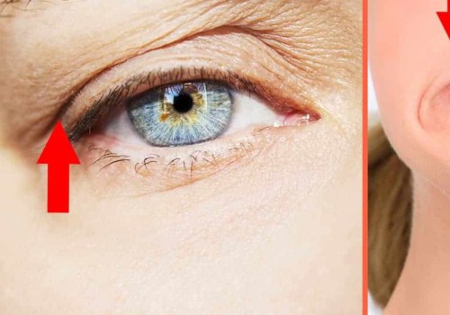 What are the Long-Term Effects of Botox?
