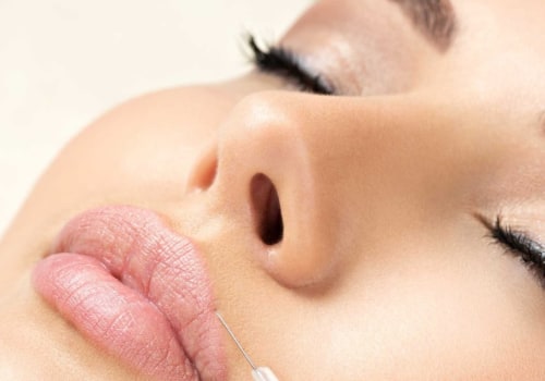 How Much Botox Do You Need for a Full Facial Treatment?