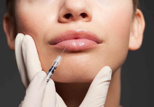 Can You Get Botox 2 Months Apart? An Expert's Guide