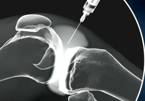 Is Botox a Steroid Injection?