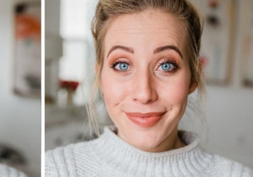 How Many Units of Botox Do You Need for Your Forehead?