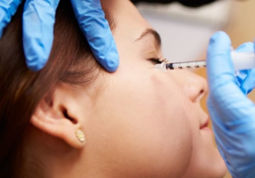 Botulinum toxin injections